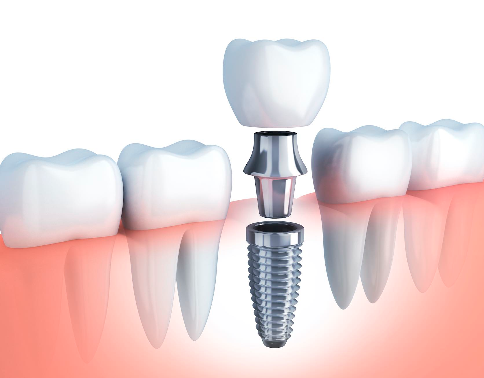 Materiais para a biocompatibilidade